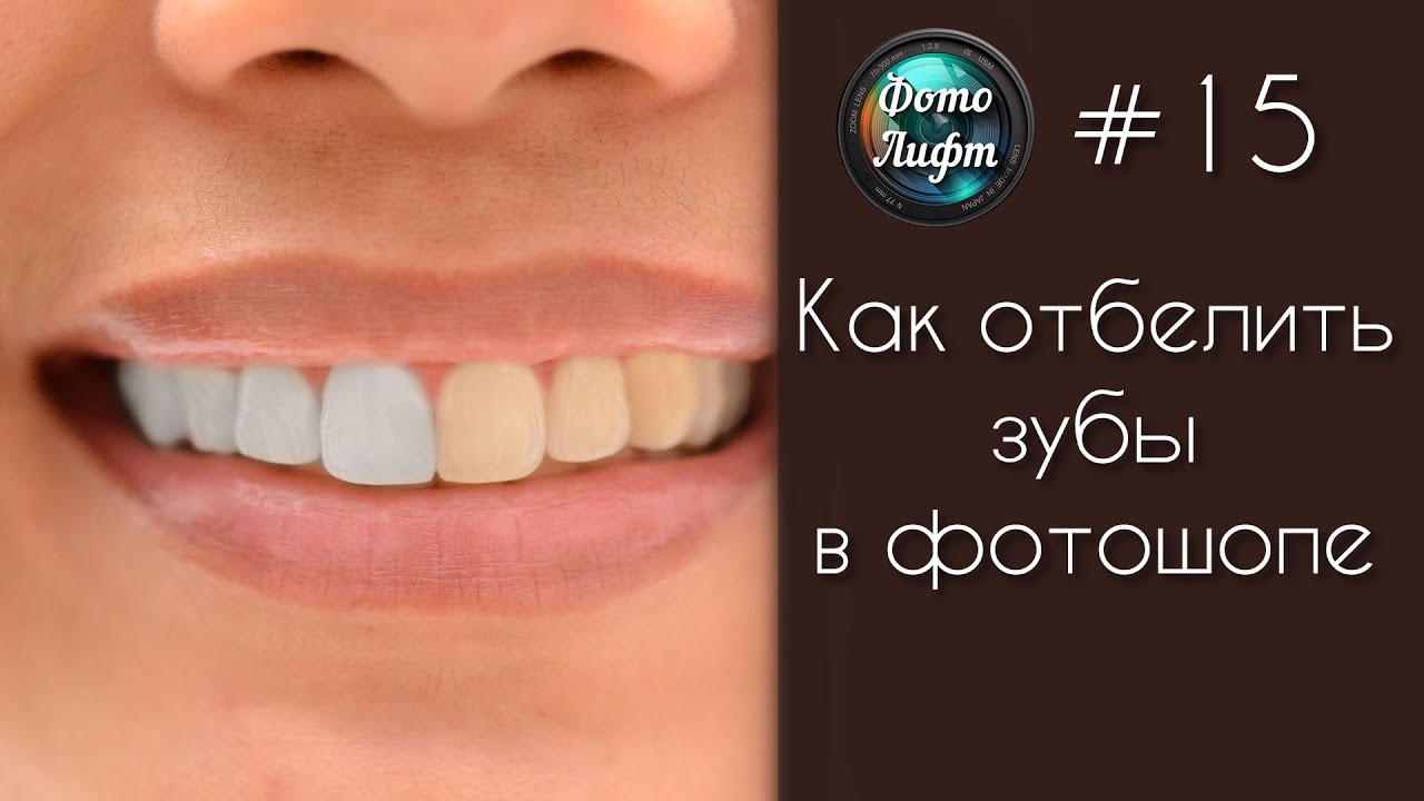 Отбеливаем зубы в photoshop Отбеливаем зубы в photoshop