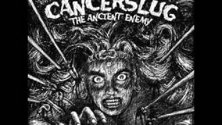 Watch Cancerslug The Ancient Enemy video