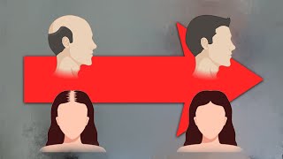 Nuevo tratamiento alopecia: CLASCOTERONA