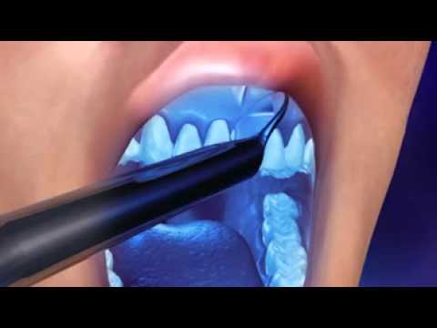 examen au speculum et video