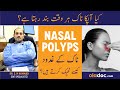 Nasal Polyps Ka Ilaj - How To Treat Nasal Polyps - Nak Ke Gadood Ka Ilaj - Nasal Polyps Symptoms