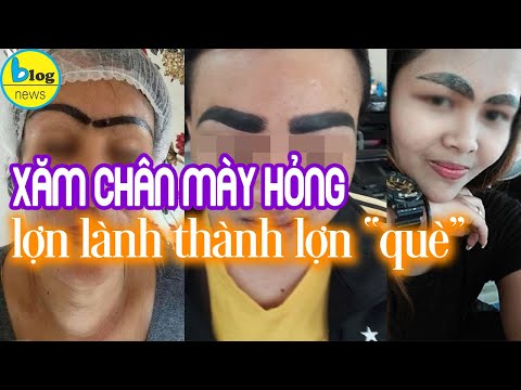 Những biến chứng gây “hoang mang” khi phun xăm chân mày tại cơ sở kém chất lượng