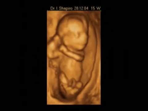 Fetus Play - Dr. Shapiros 3D ultrasound of boy baby enjoying...