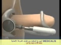 تكبير الذكر بطريقة طبيعية , كيفية تكبير القضيب