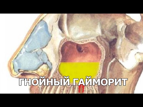 Как правильно готовить индейку Официальный сайт кулинарных Как можно оказать помощь при зубной боли ребёнку