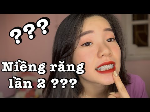 MÌNH LẠI NIỀNG RĂNG LẦN 2 ?! Lý do, Chi phí, Thời gian, Cách niềng...