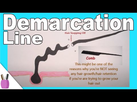 demarcation line hair natural