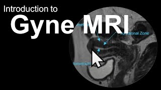 Introduction To Gyne Mri Female Pelvis Case-Based Course