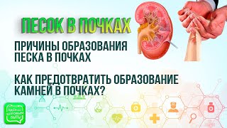 Песок В Почках | Чем Опасен Песок В Почках?