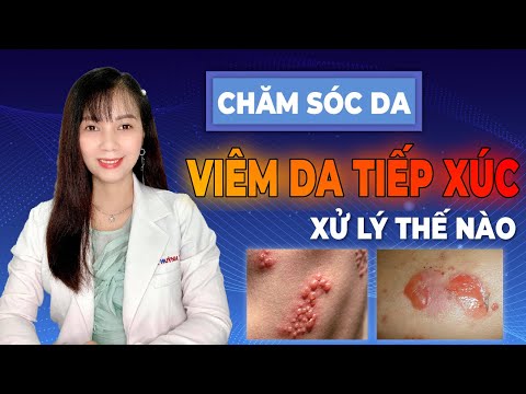 CHĂM SÓC DA - Chữa Bệnh Viêm Da Tiếp Xúc Như Thế Nào? | Dr Huỳnh Trang
