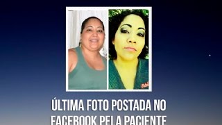 Depoimento Damaris B. - Lúpus Eritematoso Sistêmico