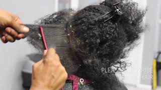 Picking BIG scalp flakes Psoriasis and Dermatitis SEW IN WEAVE REMOVAL