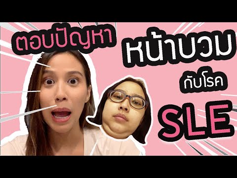 อีป่วย EP.1 เคลียร์ปัญหาหน้าบวมกับโรคSLE