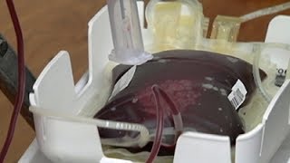 SANBS calls for more donors to give a gift of life