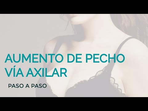El pecho más grande en rossii no de silicio