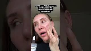 Have You Tried Peel Shot Skin Exfoliator Yet? Dr Melaxin Peel Shot Has Earned A Place In My