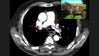 High Yield Ct Scans Part 1 Usmle
