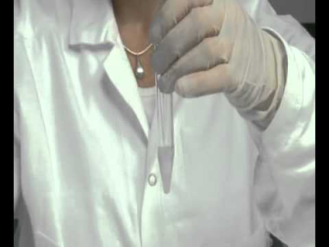 Sex before iui donor sperm