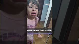 Menina De 5 Anos Fica Com Os Lábios Inchados Após Prender A Boca Em Tampa