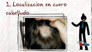 Sintomas De Dermatofitosis