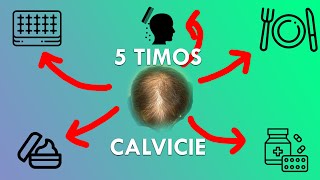 5 TIMOS CALVICIE que PUEDES CAER