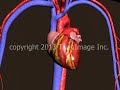 Mitral Valve Prolapse and Mitral Regurgitation - Animation and Narration by Cal Shipley, M.D.
