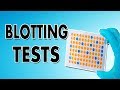 Blotting Techniques (Western Blot, Southern Blot and Northern Blot)