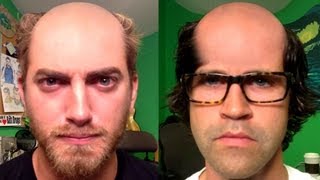 Bald girl dating