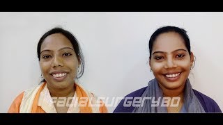 Gummy Smile Treatment in Bangladesh (Done By Dr. Abdullah Al Masud)
