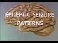 epileptic seizure patterns - medical training 1963
