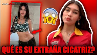 Qué Es La Extraña Cicatriz Que Tiene La Cajera Del Oo? Y Que Cautivó A Todos Con Un Micro-Top