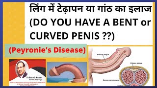 Ling Me Dard Ganth Aur Tedhapan Peyronies Disease Peyronies Disease टढ लगDr.santosh Kumar Pgi