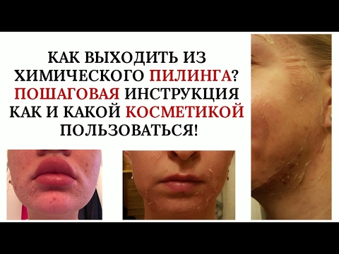 Когда можно использовать пилинг для лица Когда можно использовать пилинг для лица