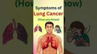 Symptoms Of Lung Cancer How You Know