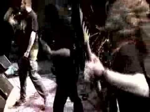 SANATORIUM - Fetus Rape