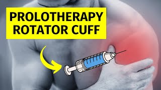 I Review Prolotherapy for Shoulder Pain and Rotator Cuff