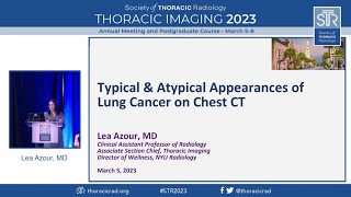 Typical And Atypical Appearances Of Lung Cancer On Chest Ct
