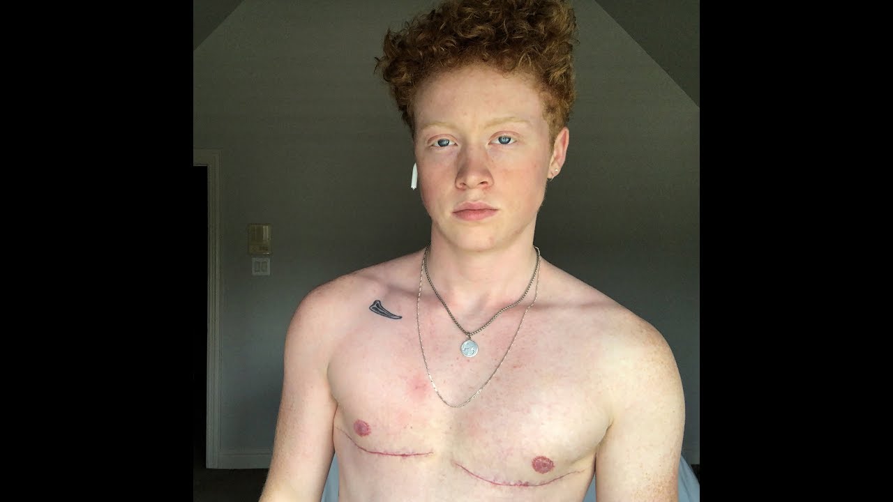 Ftm post metoidioplasty fucks his