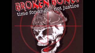 Watch Broken Bones Dead Inside video