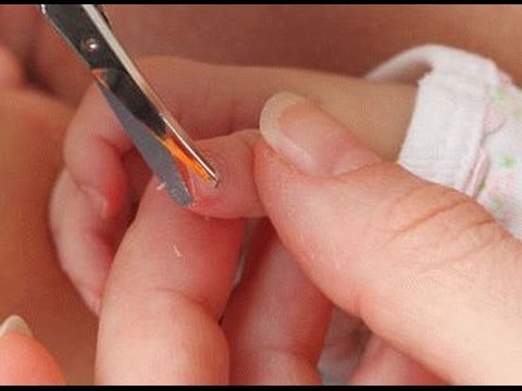 Как стричь ногти новорожденным комаровский Как стричь ногти новорожденным комаровский