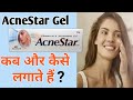 Acnestar Cream Usage | Acnestar To Treat Acne And Pimples | How To Use Acnestar Gel