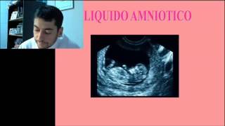 GRAVIDEZ DE ALTO RISCO - Dr Marcos Caetano - VÍDEO 3
