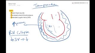 Cardiac Tamponade - Dr Jamal USMLE