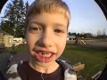 How to pull out a tooth with a rocket...
