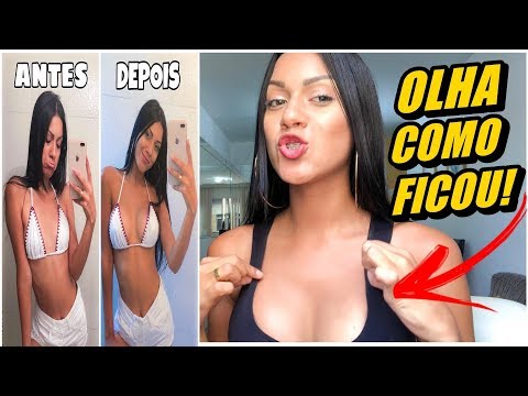 A TRANSFORMAÇÃO!!! MEU ANTES E DEPOIS DO SILICONE (OLHA COMO FICOU 😱) #DIÁRIODOSILICONE