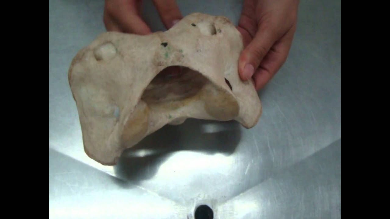 1ª vertebra cervical Atlas de equino - anatomia animal - YouTube