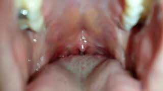 Maw