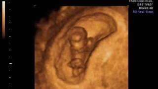 9 haftalık gebelikte anne karnındaki bebeğin ultrasonografi görüntüleri ve hareketleri