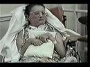 Title:Part 1 Treatment with Dr. Hammesfahr Description:She suffered several strokes that left her in a "locked in syndrome". She did very well the first three weeks, but wait until you see her during her follow up visit. To see her follow up go to GZ. D. Part 2. To contact Dr. Hammesfahr's office call 727-347-1238. ...