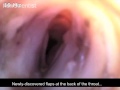 Frisky deep voice recreated in dead male koalas